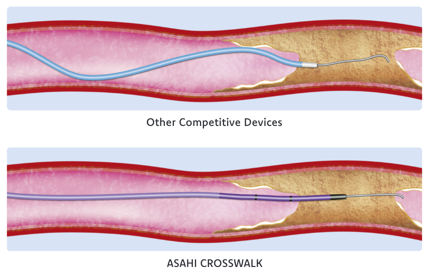 Asahi Crosswalk Comparison